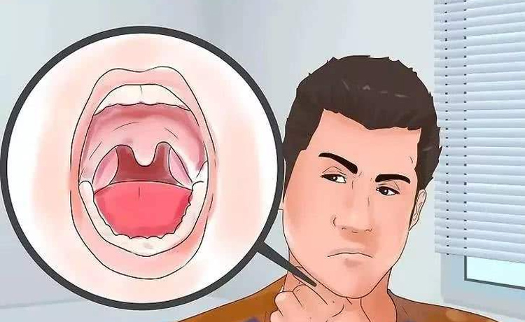 丽滋卡尔高端体检中心丨什么是口干症